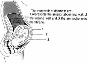 Three Veils Of Darkness in Womb